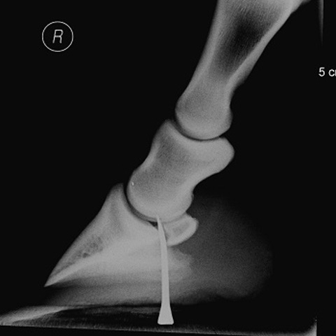 Foot Penetration Neil Townsend